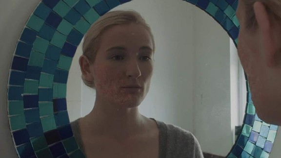A young woman with a disfigured face looks at herself in a mirror