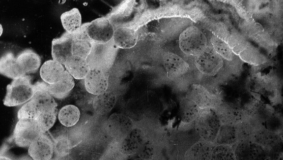 Minute Bodies: The Intimate World of F. Percy Smith