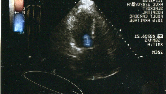Adult Cardiac